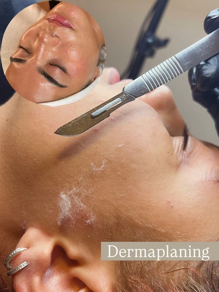 DERMAPLANING's foto | Laiz's  Salon-Academy |  BizneCubano